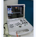 Upgraded Version Laptop Color Doppler Ultrasound Machine